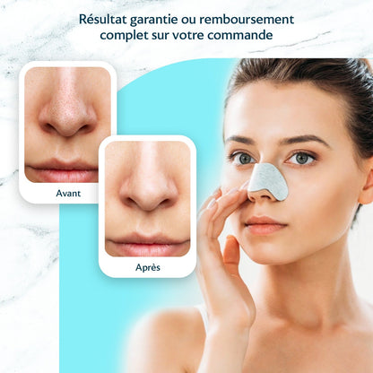 Pack Ultime Détox - Masque Anti-Points Noirs RevaSkin